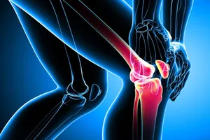 آیا کپسول مکمل برای درمان آرتروز زانو مفید است؟ (فیلم)