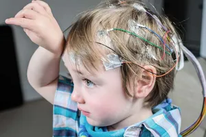 تشنج در کودکان چه زمانی تبدیل به صرع می‌شود؟