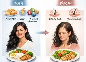 چرا حذف برنج باعث ریزش مو می‌شود؟ | علت علمی